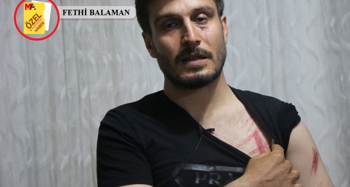 Bismil’de polis şiddeti: Çocuğuyla birlikte yaralandı