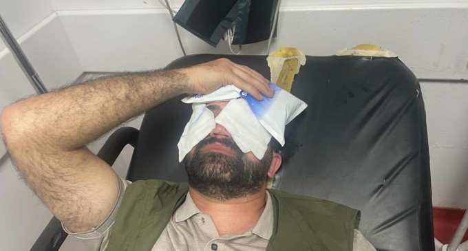 HDP’li Orak’a polis şiddeti: Ameliyatlı gözüne gaz sıkıldı